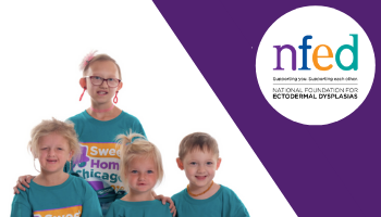 This image for Image Layouts addon